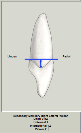Ext Morph Mx Lateral Distal 1.png